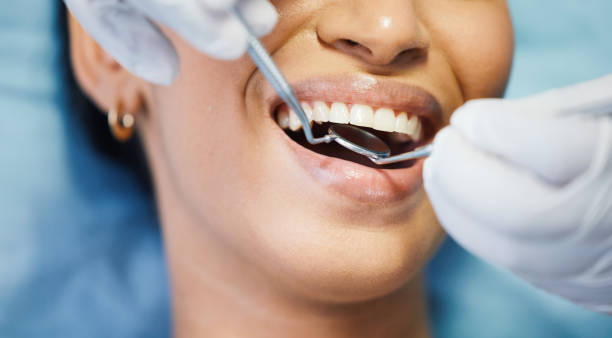 Best Emergency Dental Care for Broken or Chipped Teeth in Bay City, OR